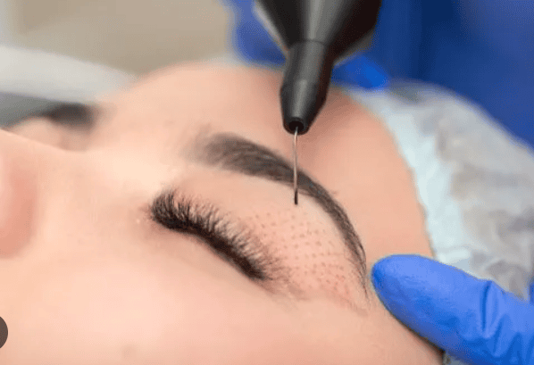 Fibroblast Behandling - Din Guide til Naturlig Foryngelse